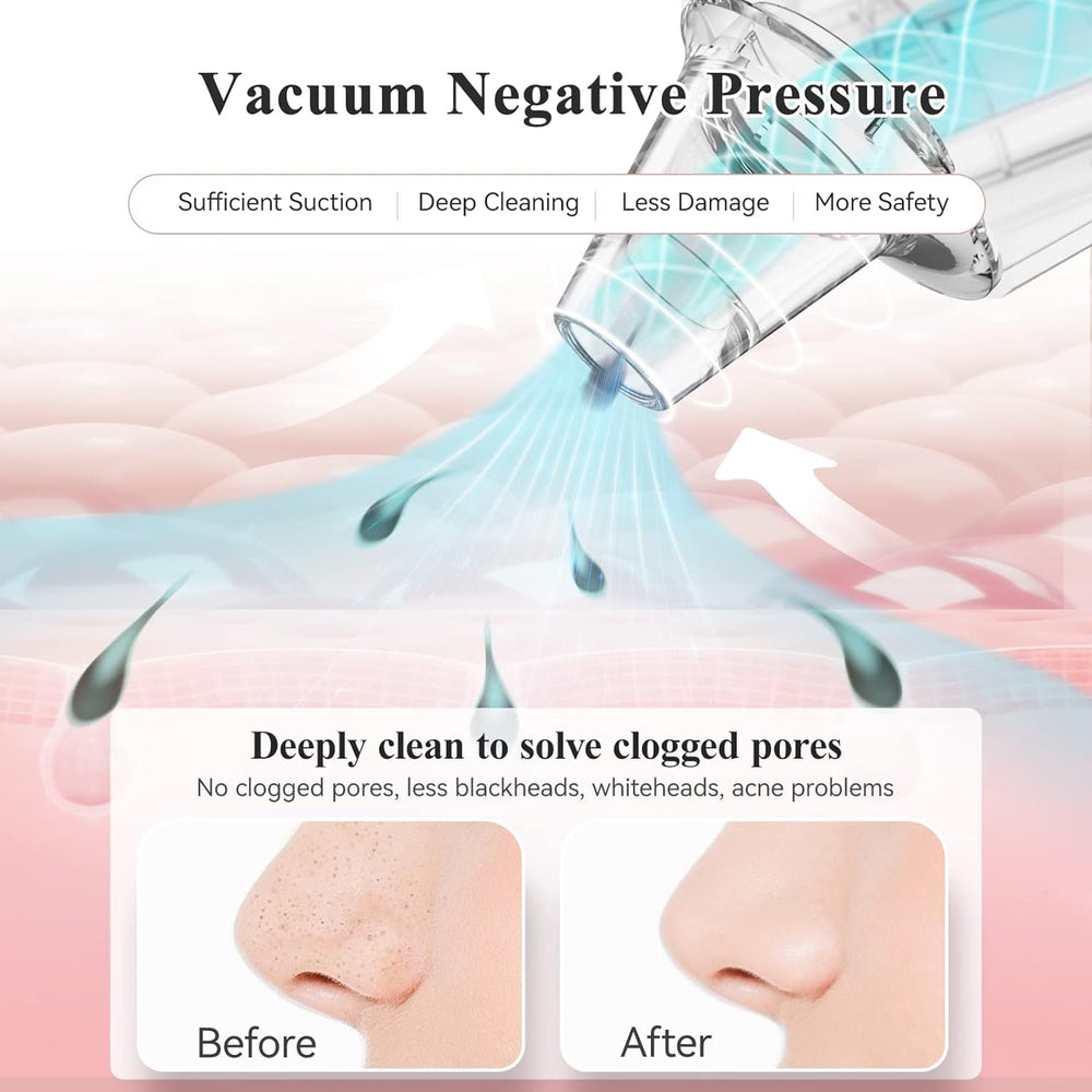 Urja Enterprise Plus Edition Multi-Function Blackhead Whitehead Remover Device, Skin Cleaner, Pimple Removal Tool, Acne Pimple Cleaner Vacuum Suction for Men and Women (Plus Edition)
