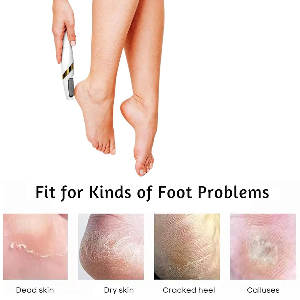 Urja Enterprise Rechargeable Callus Remover for Feet – Electric Foot File with 2 Speed Modes, 2 Interchangeable Rollers, Type-C Charging, Up to 120 Min Use, Pedicure Tool for Smooth, Soft Skin